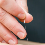 dry-needling-melbourne