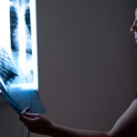 x-ray-harmful2